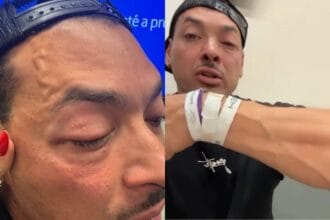 Felipe Franco detalha agressão durante show: “Nem vi de onde foi”
