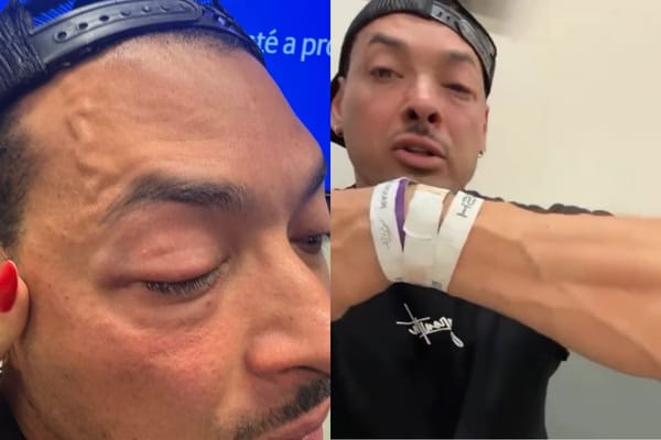 Felipe Franco detalha agressão durante show: “Nem vi de onde foi”