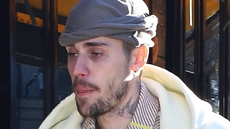 Justin Bieber quebra o silêncio para explicar a verdade por trás de sua aparência desgrenhada em meio a temores de fãs de uso de drogas pesadas