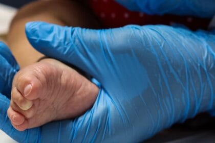 Dia Mundial das Doenças Raras reforça importância do teste do pezinho