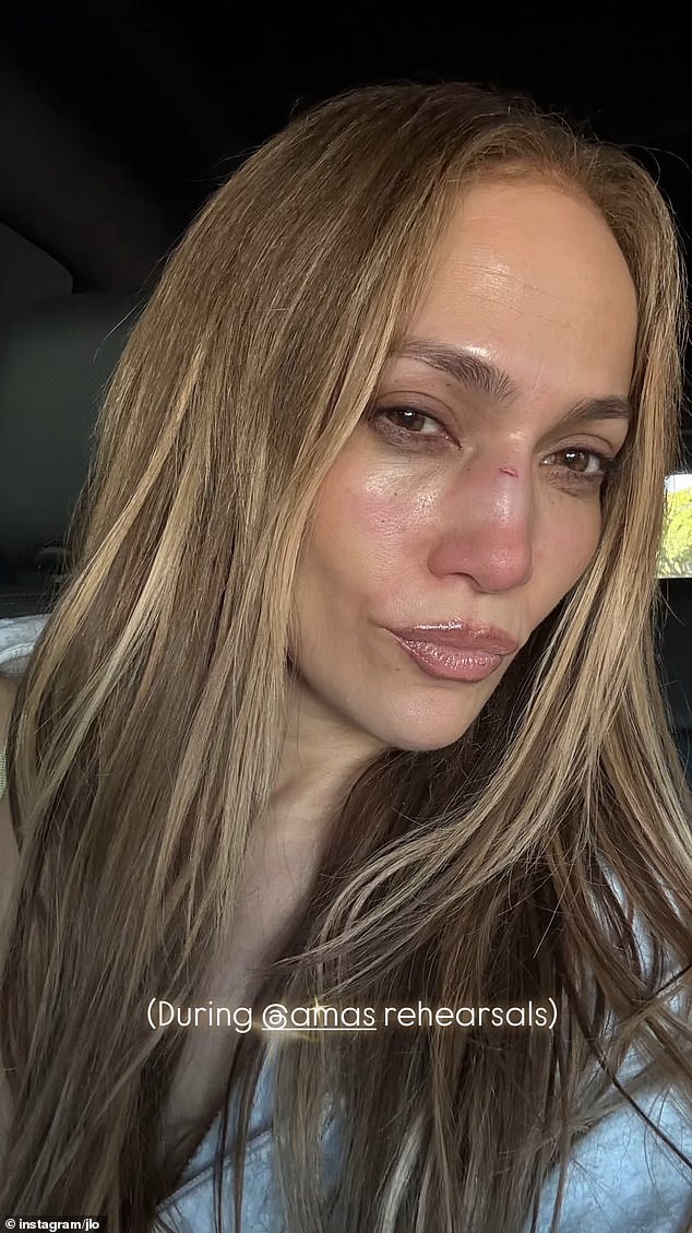 Lopez sofreu uma lesão potencialmente alterando a carreira que exigia ação rápida de um cirurgião plástico de celebridades