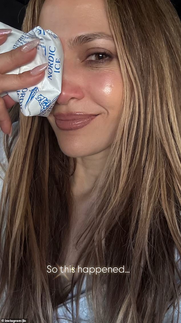 A sirene revelou em um post do Instagram Stories que ela machucou o rosto no decorrer dos ensaios para a próxima cerimônia de premiação